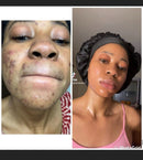Advanced halfcast whitening day & night lotions